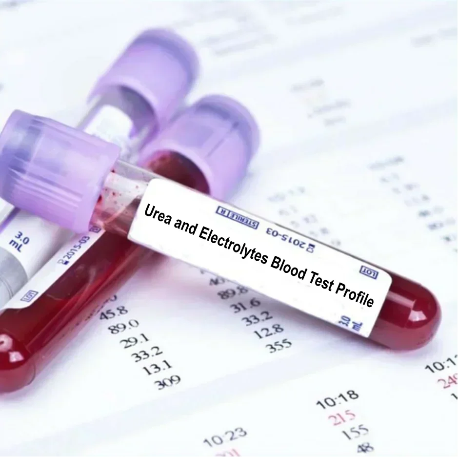 Urea and Electrolytes Blood tests