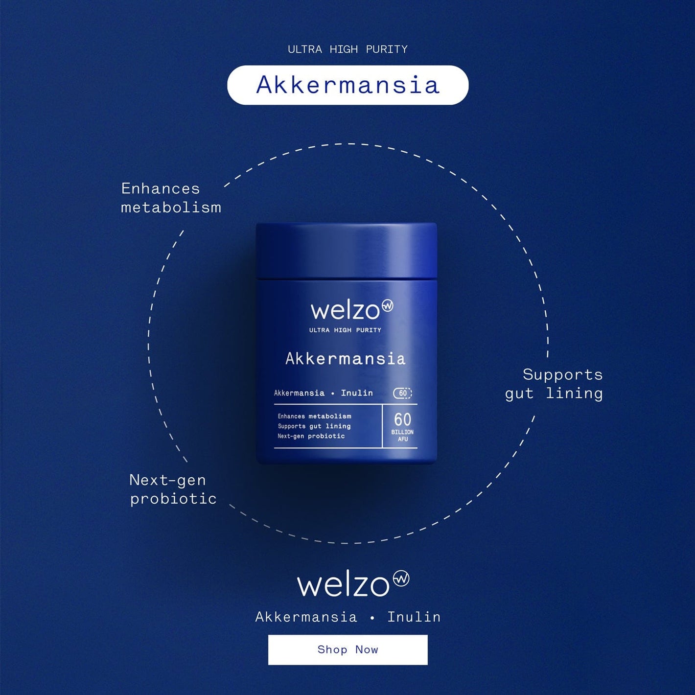 lactose intolerance supplements