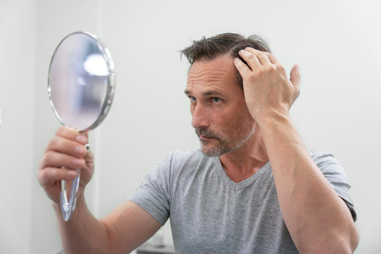 Do you have a receding hairline? 5 signs