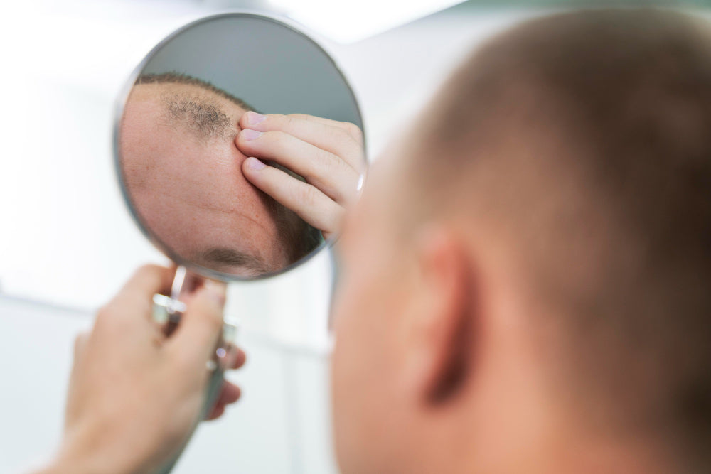 The early signs of balding and how to stop them?