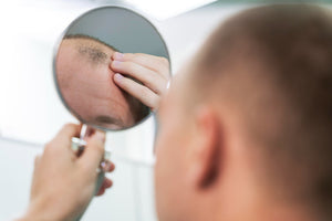 The early signs of balding and how to stop them?