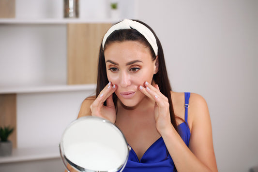 Is Sudocrem Good for Spots and Acne?