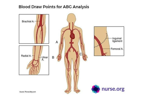 Arterial blood gases (ABGs) - welzo