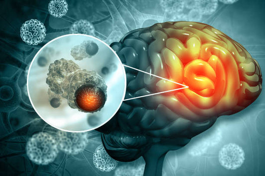 Brain tumor abnormal mass of cells that develop in or near the brain