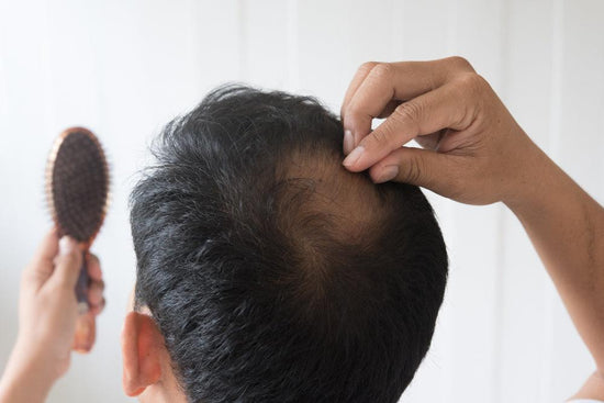 Can stress cause hair loss? - welzo