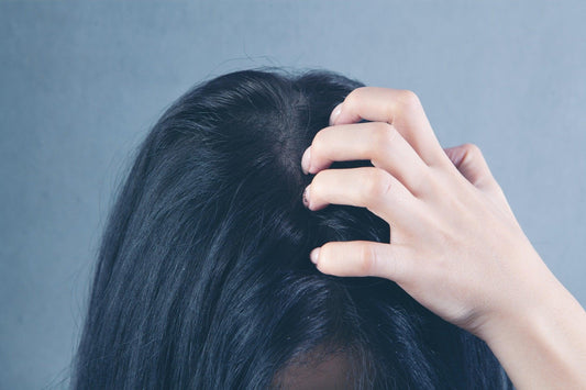 Cures for itchy scalp and hair loss