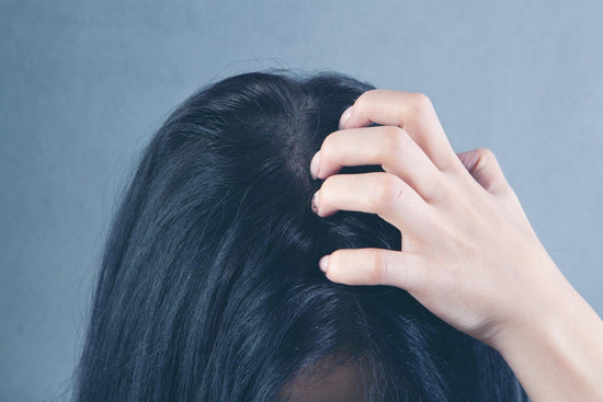 Cures for itchy scalp and hair loss - welzo