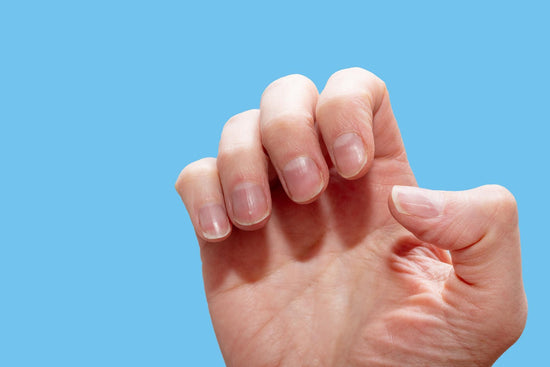 Does kidney disease affect nails? - welzo