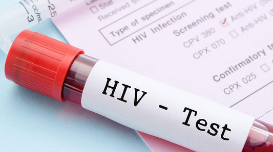 HIV Testing: A Comprehensive Guide to Detection, Benefits, and Recommendations - welzo