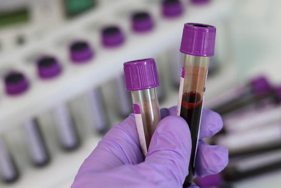 Is Blood Testing Important, Should You Track Your Health? - welzo