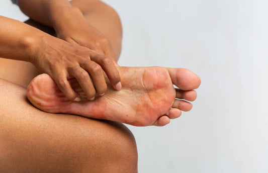 Itchy foot can have multiple causes