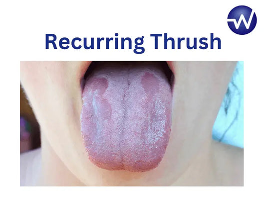 Recurring Thrush: Causes, Treatment, and Prevention - welzo