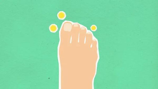 Top 7 Toenail Fungus Treatments for Fast Relief: 2024's Best Picks - welzo