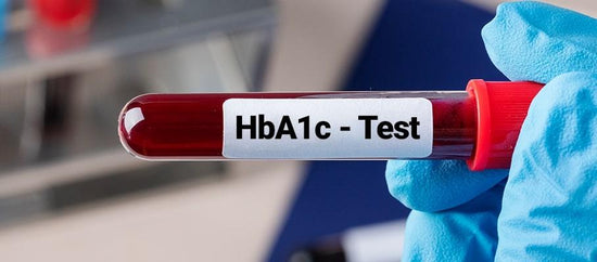 What is a hba1c blood test? - welzo