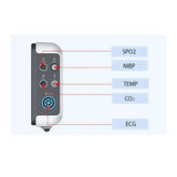 Monitoraggio del paziente ECG Touch Screen da 7 pollici portatile 6 parametri