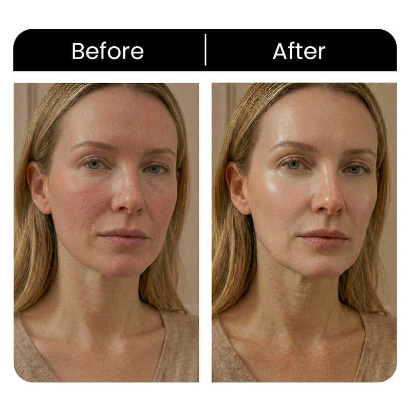 Skin LED Red Light Therapy Face Mask Anti-Ageing, Enhancing Collagen  Reduce Wrinkles