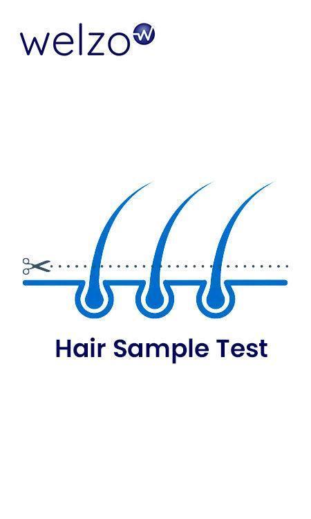 Premium Intolerance Test (Hair Sample) - welzo